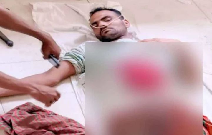 ঝিনাইদহ সীমান্তে বিএসএফের গুলিতে আহত যুবক