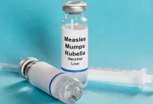 হামের টিকা নিয়ে যা বললেন বিশেষজ্ঞ! আপনার শিশুর কি প্রয়োজন আছে?