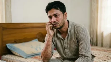 বড়দেরও হচ্ছে হাম! যা জানলে চমকে যাবেন!